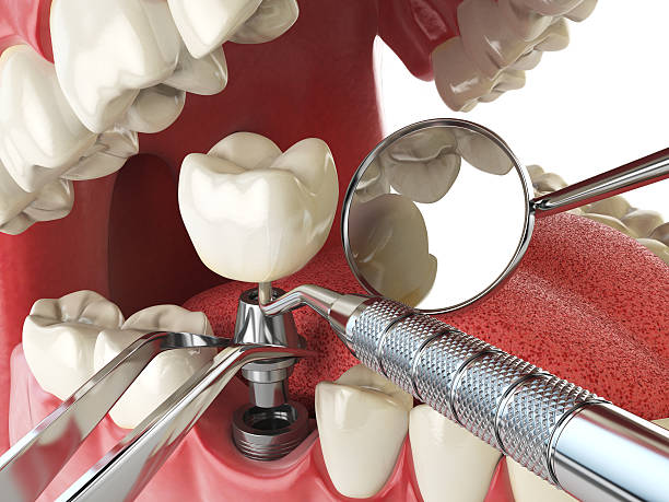 Best Emergency Cosmetic Dentistry (e.g., broken veneers) in Grosse Pointe Farms, MI